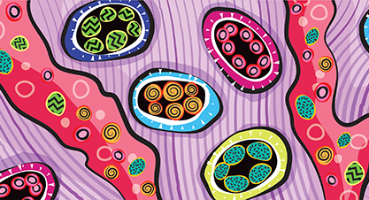 graphic image for Blood Cancer Discovery's Lymphoma Collection