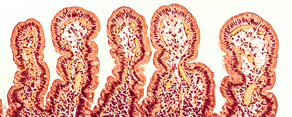 Intestinal villi