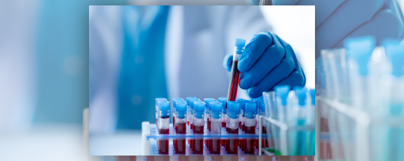laboratory technician in a lab coat placing a test tube of blood into a test tube rack