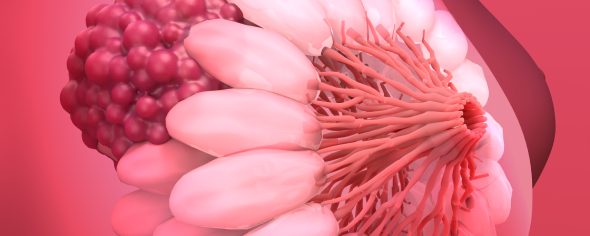 Artists rendering of underlying breast tissue and tumor