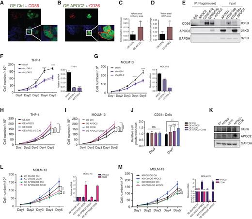 Figure 3. APOC2 interacts and cooperates with CD36 to promote leukemia growth. A and B, Confocal microscopy images showing the colocalization of CD36 and APOC2. 293T cells were cotransfected with mCherry-CD36 and empty-GFP or mCherry-CD36 and APOC2-GFP plasmids and imaged 48 hours later by confocal microscopy. C and D, Quantitative analyses of colocalization area conducted by ImageJ. Pictures were taken from ten different fields for each slide (duplicate slides were used for each condition) and combined results of two different experiments were reported. E, Immunoprecipitation (IP) assay demonstrating the interaction between flag-CD36 and APOC2. 293T cells were cotransfected with flag-CD36 and APOC2 plasmids; flag antibody was used to pull-down CD36; APOC2 antibody was used to detect APOC2 in IP lysates as well as input in Western blot. F and G, Effects of tetracycline-controlled CD36 knockdown on cell proliferation in THP-1 and MOLM-13 cells. H and I, Effects of ectopic expression of APOC2, CD36, and both on cell proliferation in THP-1 and MOLM-13 cells. J, Viability of CD34+ cells ectopically expressing empty vector, APOC2, CD36, and both on days 3 and 7. K, The expression level of APOC2 and CD36 was detected by Western blot. L and M, Effects of knocking down APOC2 and CD36 on the proliferation of OE APOC2 and CD36 stable cells, respectively. mRNA levels of APOC2 and CD36 changes were confirmed by qPCR. The difference between groups was analyzed by unpaired t test (****, P < 0.0001; ***, P < 0.001; **, P < 0.01; *, P < 0.05; ns, not significant).
