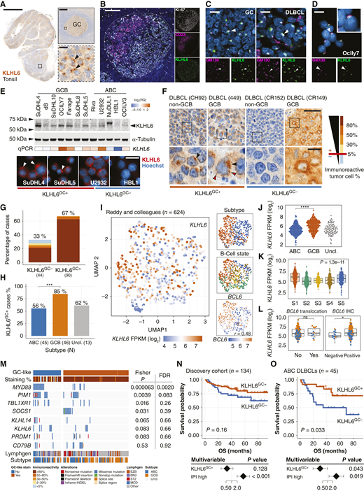 Molecular framework and clinical significance of KLHL6 protein expression in DLBCL. P values for pairwise comparisons indicated as >0.05, ns; <0.05, *; <0.01, **; <0.001, ***; <0.0001, ****. A, Representative microscopy images of IHC staining of the human tonsil for KLHL6. Arrowheads indicate cells with representative GC-like subcellular staining (KLHL6GC+). Scale bars, 5,000, 200, and 20 μm. B, Representative IF microscopy image of a GC in a reactive human tonsil (tonsils, n = 3; lymph nodes, n = 4) co-stained for light zone marker CD23, dark zone marker Ki-67, and KLHL6. Scale bar, 200 μm. C and D, IF microscopy images representative of KLHL6 subcellular localization, co-stained with GM130 (Golgi marker) and DAPI (DNA marker, blue) obtained from GC of lymph node and DLBCL tissue at 40× with optical sectioning and Ocily7 cells at 100× with conventional IF microscopy (D). White arrowheads pinpoint examples of colocalization. Scale bar, 10 μm. E, KLHL6 expression in DLBCL cell lines. Top, Western blot lanes with arrowhead showing the size of overexpressed KLHL6 construct (lane not shown). Middle, Heatmap of KLHL6 RNA transcript levels by qPCR. Bottom, Representative IF microscopy images of endogenous KLHL6 expression. White arrowheads pinpoint KLHL6GC+ expression. RQ, relative quantification. Scale bar, 20 μm. F and G, Representative KLHL6 IHC staining patterns in four tumors (F, training set, n = 39) and quantification in the discovery cohort (G, n = 134). Black arrowheads denote KLHL6GC+, whereas red arrowheads show additional dispersed puncta. Interpretation of KLHL6 GC-like staining shown below the images. On the right, a scale to quantify KLHL6 immunoreactivity. GC-like pattern with immunoreactivity ≥5% was considered positive. Scale bars, 50 and 10 μm. H, Bar plot of KLHL6GC+ cases in the discovery cohort (n = 134) according to molecular subtype. Fisher exact test comparing ABC and GCB. I–L, UMAP dimensionality reduction of 624 DLBCLs (34) with RNA sequencing expression data colored according to KLHL6 expression. Next to the plot, inlets of UMAP projections and dot and box plots showing KLHL6 expression within (J) molecular subtypes, (K) B-cell states and (L) BCL6 expression, translocations, and IHC positivity. Mann–Whitney U test comparisons in J and L; Kruskal–Wallis in K. M, Oncoprint of mutations in driver genes most significantly associated with KLHL6GC status in the discovery cohort (n = 110). Select MCD drivers and KLHL6 shown, genes mutated in ≥5% of the cases considered, multiple testing correction performed with FDR. N–O, Kaplan–Meier survival estimates for overall survival (OS) according to KLHL6GC+ pattern. Log-rank test. Below the estimates: multivariable Cox regression model’s HRs, 95% confidence intervals, and P values for OS with KLHL6GC+ and IPI.