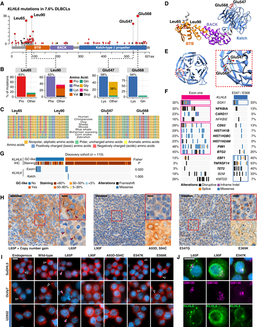 Recurrent KLHL6 mutations and their impact on subcellular localization in lymphoma cells. A, Lollipop plot of KLHL6 mutations reported in 303 DLBCL tumors. B, Bar plots showing the fraction of different amino acid (AA) changes according to the most recurrently mutated AA residues in DLBCLs. Most common AA replacement per residue highlighted as the left hand side bar. C, Evolutionary conservation of KLHL6 AA sequences in the vicinity of the most frequently mutated AA residues across selected species. D, Predicted three-dimensional (3D) structure of KLHL6 according to in silico modeling using AlphaFold. Protein domains are shown with different color shading, and recurrently mutated AA residues are highlighted. E, 3D model of KLHL6 Kelch domain seen from above with recurrently mutated glutamic acid residues E547 and E568 shown. Inlet highlights colocalization. F and G, Genetic (F) and protein localization (G) features differentially associated with KLHL6 mutations in exon one (encoding the BTB hotspot) and Kelch domain. F, Mutations enriched in other genes co-occurring with different types of KLHL6 mutations in the Lacy and colleagues data set (n = 928; ref. 38). Genes mutated in ≥5% of the patients included in the analysis. Boxed rows indicate enriched genomic drivers (Fisher exact < 0.05), genes with FDR < 0.1 bolded. G, Co-occurrence with KLHL6 staining patterns according to KLHL6GC+ status in the discovery cohort (n = 110). H, Light microscopy images of diagnostic DLBCL tissue sections immunohistochemically stained for KLHL6 from patients with different KLHL6 mutations according to the original variant calls or re-analysis. Annotated AA changes of mutations highlighted per representative figure. Red arrowheads indicate aberrant puncta in tissues with KLHL6L65P mutation. Black arrowheads indicate KLHL6GC+ pattern. Scale bars, 50 μm (10 μm for inlets). I, Representative IF microscopy images of GCB cell lines SuDHL5 and Ocily7 and ABC cell line U2932 with ectopic expression of KLHL6 WT or mutants indicated on the top. Black arrowheads indicate representative KLHL6GC+ patterns and red arrowheads indicate aberrant vesicles of KLHL6L65P. Scale bar, 10 μm. J, Representative IF microscopy images of SuDHL5 cells expressing KLHL6L65P, KLHL6L90F, or KLHL6E547K mutants. Cells co-stained for KLHL6 and Golgi marker GM130. Co-stainings of other mutants shown in Supplementary Fig. S2E. Scale bar, 10 μm.