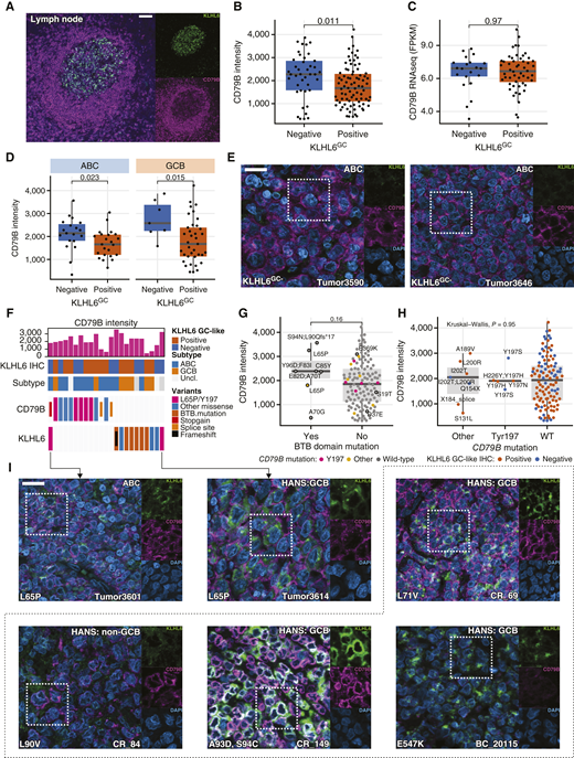 Interrogation of CD79B at the protein level in the discovery set and KLHL6-mutated tumors. P values for comparisons between two groups in box plots are calculated with the Mann–Whitney U test. Individual channels shown for the white dashed areas are shown right to the microscopy images. A, IF microscopy image of a GC in a reactive lymph node showing the highest CD79B intensity in the mantle zone, whereas KLHL6 positivity is restricted to the GC. Scale bar, 100 µm. B and C, Box and dot plots with y-axis showing (B) quantified CD79B intensity and (C) CD79B gene expression (from RNA sequencing) according to KLHL6GC+ IHC (x-axis). D, Box and dot plots of quantified CD79B intensity according KLHL6GC+ IHC phenotype within different molecular subtypes determined by gene expression profiling. E, Representative IF microscopy images of KLHL6GC- tumors showing plasma membrane–like CD79B staining. Sections stained for CD79B, KLHL6, and DNA (DAPI) and images obtained with optical sectioning and 40× objective. Scale bar, 20 µm. F, Oncoprint of patients (columns) with KLHL6 and/or CD79B mutations (n = 23). G, Box and dot plot of CD79B intensity according to KLHL6 BTB domain encoding mutation status. Amino acid changes of all KLHL6 mutations for available cases are annotated, and the presence of CD79B mutations is indicated with a color. H, Box and dot plot showing CD79B intensity according to CD79B mutations with Y197 hot spot considered separately. Color of the dots indicates KLHL6GC IHC status and amino acid changes of CD79B mutations are annotated. I, Representative IF microscopy images of tumors with different KLHL6 mutations co-stained for CD79B, KLHL6, and DNA (DAPI). Images within dashed area indicate additional KLHL6-mutated DLBCL tumors not included in the discovery cohort. Scale bar, 20 µm applies to all images.