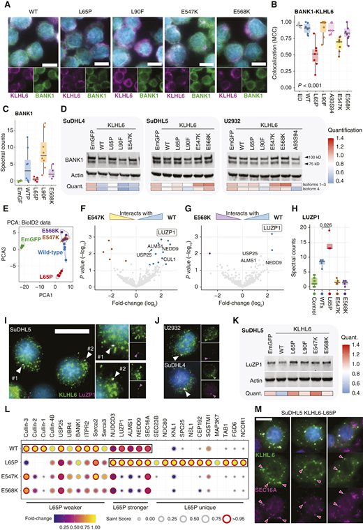 Recurrent KLHL6 mutations extend their pathogenic malfunctions to BANK1 and LuZP1. A, Representative IF microscopy images of SuDHL4 cells transduced with select KLHL6 constructs immunostained for endogenous BANK1, KLHL6, and DNA (Hoechst). WT overexpression; Scale bar, 10 µm. B, BANK1-KLHL6 colocalization for different KLHL6 overexpression constructs in SuDHL4 cells measured from fluorescent microscopy images. Staining from endogenous KLHL6 (ED) from the nontransduced parental cell line used as a control. Each point represents the correlation coefficient of one analyzed image. P value calculated with the Kruskal–Wallis test. MCC, Manders’ correlation coefficient. C, Spectral counts of BANK1 peptides from different affinity-purified in SuDHL5 pull-downs according to WT and mutant Strep-tagged baits. Dots represent biological pull-down replicates. D, Western blot analyses of BANK1 in SuDHL4, SuDHL5, and U2932 cell lines transduced with EmGFP control and nontagged KLHL6 WT and mutant constructs. Quantification of the signal intensity was normalized to a housekeeping control (β-actin) and compared with signal from EmGFP transduced cells. E, PCA of mass spectrometry data from SuDHL5 cells transduced with different BioID2-tagged constructs. F and G, Volcano plots of differentially interacting proteins between WT and Kelch mutant (E547K and E568K) BioID2-tagged KLHL6 baits. H, Spectral counts of LuZP1 in BioID2 interactome screens from SuDHL5 cells transduced with the appropriate constructs. Controls include in-house purifications with various unrelated BioID2 purifications from SuDHL5 cells to demonstrate the level of background noise for LuZP1 prey. Mann–Whitney U test. P value for comparison between WT and KLHL6L65P counts is shown. I and J, Representative IF images showing colocalization between endogenous KLHL6 and centrosomal LuZP1 proteins in unmanipulated lymphoma cell lines. Arrowheads point LuZP1 signal per representative cell. Scale bar, 20 µm. K, Western blot analysis of cell lysates from SuDHL5 cells transduced with KLHL6 WT and mutant constructs or EmGFP control. L, Balloon plot of SAINT analysis of interactome screening with BioID2-tagged KLHL6 baits. Size of the balloons represents SAINT score with high-confidence interactions (≥0.95) annotated with red borders. Fold-change of spectral counts represented with color fill. M, Representative IF images of SuDHL5 cells overexpressing KLHL6L65P mutant stained for KLHL6 and SEC16A. Red arrowheads indicate co-staining vesicles. Scale bar, 10 µm.