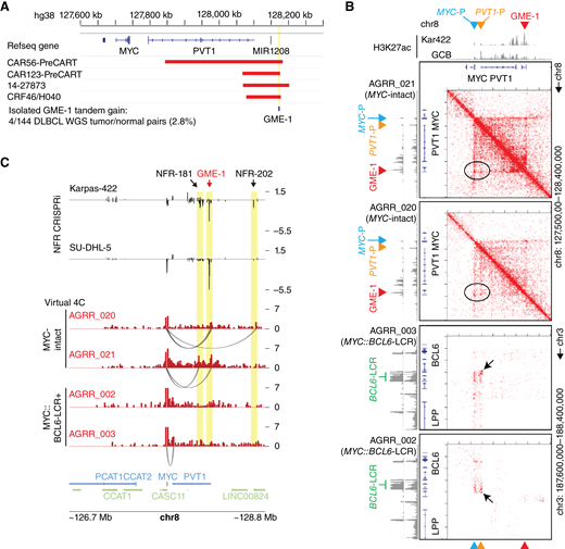 The GME-1 MYC enhancer is recurrently amplified and shows topological interactions with MYC in DLBCL biopsies lacking MYC rearrangements. A, Positions of focal genomic gains of the GME-1 MYC enhancer in primary DLBCL samples. Light red bars mark the positions of isolated genomic copy gains involving the GME-1 enhancer detected in DLBCL WGS datasets that lacked evidence for a long-distance MYC rearrangement. See Supplementary Fig. S6A for details of breakpoint and copy-number analysis for these events. B, Contact matrices for Hi-C performed on GCB-DLBCL biopsies, showing topological interactions within the MYC locus for two MYC-intact lymphomas (top) and between the MYC and BCL6 loci in two MYC::BCL6-LCR+ lymphomas (bottom). Corresponding H3K27ac ChIP-seq data from the Karpas-422 cell line and normal GC B cells (GCB; Blueprint consortium) are shown at top. Color-coded markers indicate the location of the MYC and PVT1 promoters (MYC-P and PVT1-P) and GME-1 and BCL6-LCR enhancers on the X and Y axes. Black ellipses highlight increased interactions between the GME-1 enhancer and the MYC and PVT1 promoters. Black arrows indicate chromosomal fusions identified by Hi-C Breakfinder that link the MYC gene to the BCL6-LCR. Note that the fusion in AGRR_002 is telomeric to the BCL6-LCR but in reverse orientation [chr8 (+) strand fused to chr3 (−) strand]. C, Virtual 4C contact profiles (red) for topological interactions with the MYC promoter in the four lymphoma Hi-C datasets shown in (B). The Y-axis scale shows normalized interactions (Knight–Ruiz matrix balancing) with the MYC promoter for each genomic bin. Significant looping interactions detected by hiCDetectLoops (P < 0.05) are indicated by arcs at the bottom of each profile. NFR CRISPRi screen data for Karpas-422 and SU-DHL-5 are shown at top for comparison (black, sgRNA log2 fold change is shown on the Y axis). GME-1 and other enhancers detected as essential in Karpas-422 are highlighted—note correlation with loops detected in MYC-intact biopsies.