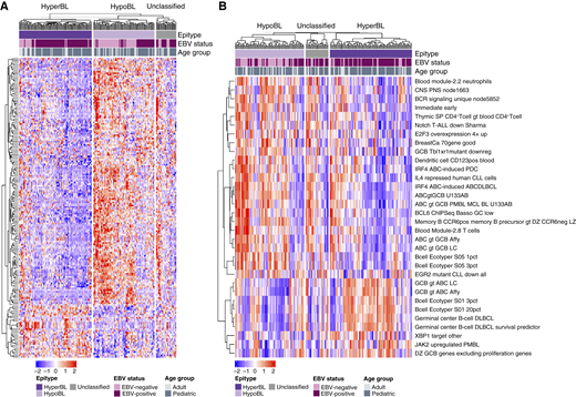 Patterns of gene expression associated with epitype membership. A, The heatmap displays the 213 differentially expressed genes between epitypes, with rows representing differentially expressed genes and columns representing samples. Rows and columns are clustered using Manhattan distances. The epitype membership and EBV status of each sample is shown at the top. Samples are split on the basis of epitype with HyperBL (n = 102) cases on the left, HypoBL (n = 88) cases in the middle, and unclassified (n = 28) cases on the right. B, Heatmap representing the expression of 32 gene sets from SignatureDB with significant (Q ≤ 0.0025) differences between epitypes. Samples from 218 patients were clustered and ordered on their expression of genes within each gene set. Rows represent the gene sets and columns represent samples. Row and columns were clustered using Manhattan distances.