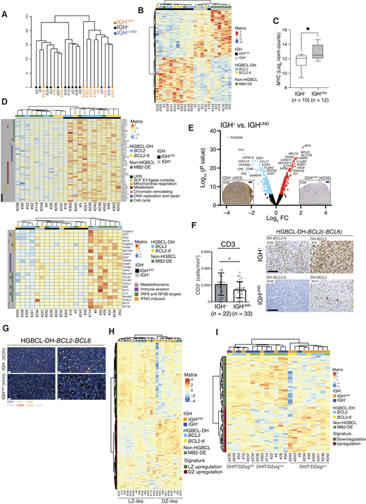 IGH+ and IGHUND HGBCL-DH-BCL2 differ in GC zone programs and immune infiltrate. A, Unsupervised clustering of GCB MB2 DE DLBCL cases (n = 22) based on whole transcriptome data, excluding IGH transcripts. Case ID is listed at the bottom. Clustering mostly separates IGH+ (black; P = 0.0004) from IGHUND (red; P = 0.0170) tumors. IGHUND/+ cases (blue) clustered with the IGHUND group. B, Heatmap of differentially expressed genes (n = 953; log2 FC > 0.58: adjusted P < 0.05) between IGH+ and IGHUND MB2 DE DLBCLs after unsupervised clustering, defining the IGHUND MB2 signature. IGH and HGBCL-DH-BCL2 status are indicated above the heatmap. Z-score normalized expression values are shown. C, Boxplot of median MYC transcript levels (horizontal line) and 5th–95th percentile (whiskers) in GCB MB2 DE DLBCLs (n = 22) clustered according to IGH status. D, Unsupervised clustering of MB2 DE DLBCL cases for selected genes respectively up- (top map) and down-regulated (bottom map) in IGHUND compared with the IGH+ subset, grouped according to gene ontology. E, Volcano plot representation of differentially expressed genes (log2 FC > 0.58: adjusted P < 0.05) between ROIs (circles, n = 3) of IGHUND and IGH+ HGBCL-DH-BCL2. Top differentially expressed genes are shown. IGM (together with IGD/G/A not shown) IHC on serial sections served to assess IGH status. F, CD3 IHC analysis in representative IGH+ and IGHUND HGBCL-DH-BCL2(-BCL6). Histograms summarize the mean number of CD3+ cells/mm2 ± SD in IGH+ (n = 22) and IGHUND (n = 33) cases. Each circle represents a case. G, Multiplex IF analysis of FFPE sections of IGH+ and IGHUND HGBCL-DH-BCL2, stained for macrophages (CD68) and B (CD20), T (CD4 and CD8A), NK (CD57), and endothelial (CD31) cell markers. H, Unsupervised clustering of IGH+ and IGHUND MB2 DE DLBCL cases (n = 22) for spatially resolved GC DZ/LZ signatures. Heatmap identifies genes preferentially expressed in DZ (red) or LZ (green) regions. IGH and HGBCL-DH-BCL2(-BCL6) status is indicated above the heatmap. I, Unsupervised clustering of IGH+ and IGHUND MB2 DE DLBCL cases (n = 22) according to the DHIT/DZ molecular signature. Transcripts positively (red) and negatively (green) associated with the DHIT/DZ signature are indicated. P values were determined by unpaired t test with the Welch correction (C and F): *, P < 0.05. FC, fold change, norm, normal.