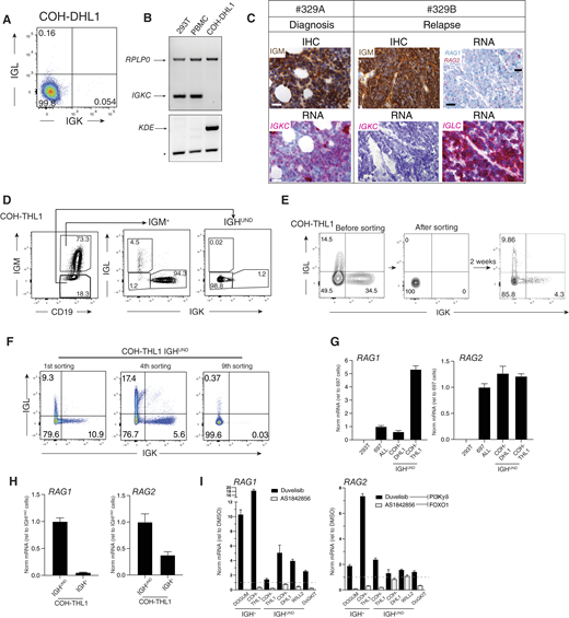 IG light chain editing fuels BCR diversity and ultimate extinction in IGHUND HGBCL-DH-BCL2 models. A, Representative sIGK/L FACS analysis of IGHUND HGBCL-DH-BCL2 COH-DHL1 cells. Cell frequencies are indicated. B, Genomic PCR amplification of a segment of the IGKC gene (top) in COH-DHL1 cells, 293T cells, and PB mononuclear cells (PBMC). Amplification of the RPLP0 gene controlled for DNA input. Genomic PCR for the KDE rearrangement was performed on the same sample set (bottom). The asterisk refers to a nonspecific PCR amplification product serving as internal loading control. C, Longitudinal monitoring of IGM (IHC) and IGKC/LC (scale bar, 20 μm) and RAG1/2 (RNA-scope) expression (scale bar, 50 and 20 μm in the inset) in the HGBCL-DH-BCL2-BCL6 case from which the COH-THL1 cell line model was established, analyzed at diagnosis (#329A) and after relapse (#329B). D, Representative IGM/IGK/IGL FACS analysis of low-passage COH-THL1 cells before (left plot) and after (middle and right plots) gating on the indicated subsets. Numbers indicate cell frequencies. E, Representative (n = 5) sIGK/L FACS analysis of COH-THL1 bulk cultures before (left), at the time of sorting of IGHUND variants (middle) and after 2 weeks of in vitro culture (right) of the latter cells. Numbers indicate cell frequencies. F, Longitudinal tracking of sIGK/L expression of COH-THL1 cells profiled 2 weeks after consecutive rounds of FACS sorting for sBCRnull cells. Note the progressive erosion of sIGK/L+ cells at the expense of sIGK/Lnull cells. G, Normalized RAG1/2 transcript levels in IGHUND COH-DHL1 and COH-THL1 cells relative to 697 pre-B leukemia cells, measured by qRT-PCR. HEK293T cells were included as negative controls. H, Normalized RAG1/2 transcripts in FACS-purified IGH+ and IGHUND COH-THL1 cells, quantified by RT-PCR. I, Quantitative measurement of RAG1/2 transcripts in the indicated HGBCL-DH-BCL2(-BCL6) lymphoma lines, treated for 48 hours with the PI3Kδ/γ inhibitor duvelisib or FOXO1 inhibitor AS1842856. Transcripts are normalized to RPLP0 and represented as relative to the vehicle control set at 1 (dashed line). Data represent n = 6 (A and D) n = 5 (E), and n = 3 (B, G, and H) experiments.