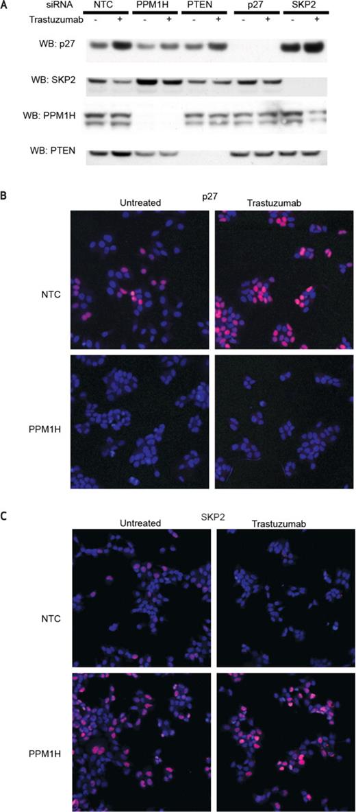 Figure 3. PPM1H regulates expression of p27 and SKP2. A, Western blot showing expression of p27, SKP2, PPM1H, and PTEN with and without siRNA knockdown of the same genes. B, p27 immunofluorescence with and without PPM1H knockdown and with and without trastuzumab treatment. C, SKP2 immunofluorescence with and without PPM1H knockdown and with and without trastuzumab treatment. Scale bar = 100 μm.