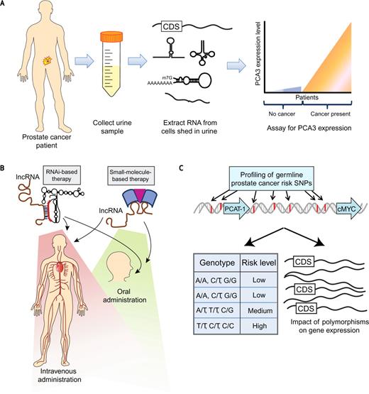 Figure 4. Clinical implications of lncRNAs. A, the PCA3 urine biomarker test for prostate cancer employs a noninvasive approach to disease diagnosis by collecting urine samples from patients, isolating nucleic acids from cells in the urine sediment, and quantifying PCA3 expression. B, lncRNA-based therapies may target the lncRNA by utilizing either RNA interference (RNAi), which uses sequence homology between the lncRNA and the RNAi therapeutic molecule, or a small-molecule therapy that interacts with the lncRNA. These therapeutic avenues may be appropriate for systemic therapy by either intravenous or oral administration. C, GWASs may provide germline polymorphisms that predict an individual patient's clinical risk for disease development, response to therapy, or disease aggressiveness, while also providing molecular information through the impact of polymorphisms on gene expression of key genes. CDS, coding sequence.