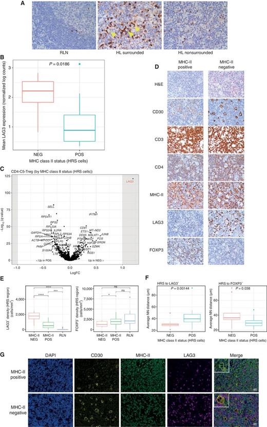 Single-Cell Transcriptome Analysis Reveals Disease-Defining T-cell ...