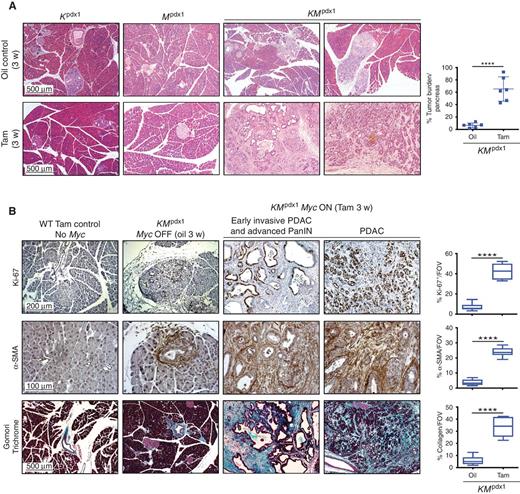 Figure 1. MYC drives progression from PanIN to pancreatic adenocarcinoma in KMpdx1 mice (related to Supplementary Figs. S1–S3). A, Left, representative hematoxylin and eosin (H&E)–stained sections of pancreata harvested from 15-week-old Kpdx1 (KrasG12D only; left), Mpdx1 (MycERT2 only; second column), and KMpdx1 (KrasG12D and MycERT2; right two columns) mice treated with either oil control (top row) or tamoxifen (Tam; bottom row) for 3 weeks. Scale bars apply across each row. Right, percentage tumor burden relative to total pancreas in KMpdx1 mice treated with either oil (control) or tamoxifen is shown. Each point refers to an individual mouse. Results represent mean ± SD, n = 6 mice per treatment group. The unpaired Student t test was used to analyze tumor burden. ****, P < 0.0001. B, Left, representative IHC staining for proliferation (Ki-67, top row), α-smooth muscle actin (α-SMA; second row), and collagen deposition by Gomori Trichrome staining (blue-stained collagen, bottom row) in sections of pancreata harvested from 15-week-old wild-type (WT) control mice treated with tamoxifen alone (No Myc, first column) versus age-matched KMpdx1 mice treated with either oil (Myc OFF, second column) or tamoxifen (Myc ON, third and fourth columns) for 3 weeks. Column 3 shows examples of early invasive PDAC and advanced PanIN. Column 4 shows examples of frank PDAC. Scale bars apply across each row. Right, box-and-whisker quantitation plots showing upper extreme, upper quartile, median, lower quartile, lower extreme. n = 5–7 mice for each treatment group. ****, P < 0.0001. Data were analyzed using unpaired t test. FOV, field of view.