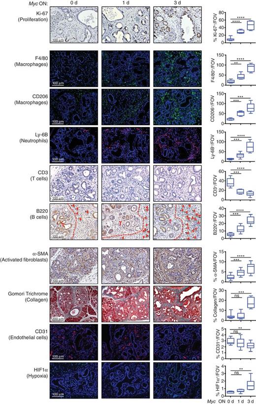 Figure 2. MYC instructs immediate onset of transition to pancreatic adenocarcinoma in KMp48 mice (related to Supplementary Fig. S4). IHC and immunofluorescence (IF) analyses of immediate pancreatic tumor–stromal changes at 0, 1, and 3 days post Myc activation in KMp48 mice. Left, representative staining for proliferation (Ki-67 IHC), macrophages (F4/80/EMR1 and CD206/MRC1 IF), neutrophils (Ly-6B IF), T cells (CD3 IHC), B cells (B220 IHC: red arrows indicate B220+ cells, broken line marks tumor border), activated fibroblasts/stellate cells (α-SMA IHC), collagen (Gomori Trichrome), vascular endothelial cells (CD31/PECAM IF), and hypoxia (HIF1α IF) of pancreata harvested from 12-week-old KMp48 mice before Myc activation (0 days, left column) or tamoxifen for 1 or 3 days (Myc ON, second and third columns, respectively). Scale bars apply across all images. Quantifications are shown to the right. n = 5–7 for each treatment group. **, P < 0.01; ***, P < 0.001; ****, P < 0.0001; ns, nonsignificant. Data were analyzed using unpaired t test. FOV, field of view.
