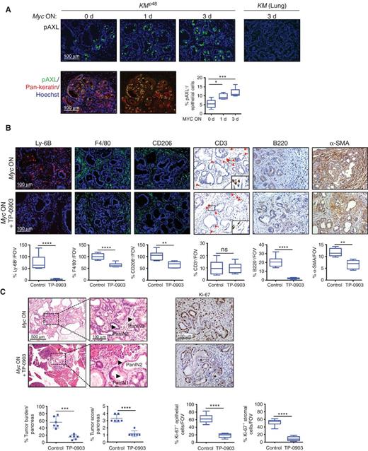 Figure 4. Inhibition of the GAS6–AXL pathway selectively blocks a subset of MYC-induced stromal changes in KMp48 pancreatic tumors (related to Supplementary Fig. S5). A, Top row, IF of phospho-AXL (pAXL; green) and its quantification in pancreata of 12-week-old KMp48 mice treated with oil (Myc OFF, top left) or tamoxifen for 1 day (middle) or 3 days (right; Myc ON), together with corresponding quantitation. The absence of detectable pAXL staining in section of a KrasG12D-driven lung adenoma in which Myc had been activated for 3 days (74) is shown for comparison (extreme right). Bottom row, representative colocalization of pAXL (green) and pan-keratin (red, epithelial cells). Scale bar applies to all images. Percentage of epithelial cells positive for pAXL is quantified. n = 5–7 per group. *, P < 0.05; ***, P < 0.001. B, Representative IF staining for neutrophils (Ly-6B), macrophages (F4/80 and CD206) and IHC staining of T cells (CD3), B cells (B220), and myofibroblasts (α-SMA) of pancreata sections from mice treated with tamoxifen (Myc ON) for 5 days in either the absence (top row) or presence (bottom row) of the pAXL inhibitor TP-0903. Inset shows boxed region at higher magnification. Scale bar applies to all images. Relevant quantitation is provided under each column. n = 5–6 per group. **, P < 0.01; ***, P < 0.001; ****, P < 0.0001. C, Representative H&E staining and Ki-67 IHC of pancreata from 12-week-old KMp48 mice either untreated (top row) or treated (bottom row) with AXL inhibitor TP-0903 during Myc activation (Myc ON) for 5 days. Insets show higher magnifications. Black arrows indicate PanIN 1, 2, and 3. Scale bars apply across each column. Corresponding quantitation of tumor burden, tumor score, and Ki-67 staining in epithelial and stromal compartments (bottom row) in pancreata of mice described above. The tumor score is calculated as follows: score 1 with <10% of the lesions are PanIN 3, score 2 with 10% to 25% of the lesions are PanIN 3, score 3 with >25% to 45% of the lesions are PanIN 3, score 4 with >45% of the lesions are PanIN 3. n = 6 mice per treatment group. ***, P < 0.001; ****, P < 0.0001. FOV, field of view.