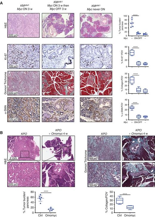 Figure 5. Continuous Myc activity is required for PDAC maintenance (related to Supplementary Fig. S8). A, Representative H&E (top row), Ki-67 IHC for proliferation (second row), Gomori Trichrome staining for collagen (third row) and α-SMA IHC for myofibroblasts (bottom row) in sections of pancreata from 12-week-old KMpdx1 mice in which Myc was continuously activated for 3 weeks (left column) or activated for 3 weeks and then deactivated for 3 weeks (middle column). For comparison, age-matched control pancreata in which Myc was never activated (treated with oil for 3 weeks, then untreated for 3 weeks) are shown (right column). Quantitation of tumor burden in individual mice from each cohort is shown to the right, as is quantitation of Ki-67, collagen, and α–SMA. n = 5–6 per group. **, P < 0.01; ***, P < 0.001; ****, P < 0.0001. Quantitation after 3 weeks of sustained Myc activation is from the same animals as shown in Fig. 1. B, Representative H&E (left) and Gomori Trichome–stained (right) sections of pancreata from 10-week-old Kpdx1; Trp53ERTAM KI (KPO) mice without (left) or with (right) Omomyc expression for 4 weeks. Quantitation of tumor burden and collagen is shown below. n = 6 per group. ****, P < 0.0001. FOV, field of view.