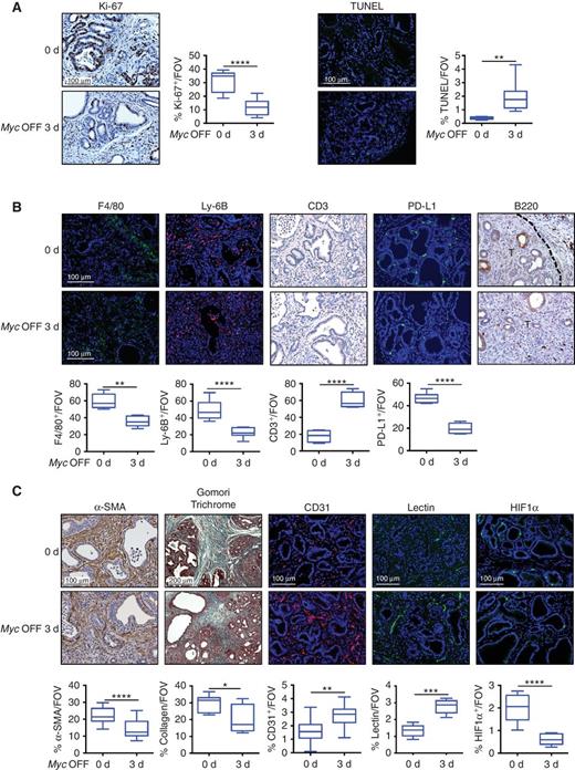 Figure 6. Myc deactivation triggers immediate onset of regression of KMp48 tumor stroma (related to Supplementary Fig. S9 and S10). Analysis of pancreata from 12-week-old KMp48 mice treated with tamoxifen (Myc ON) for 3 weeks (Myc OFF 0 days) and 3 days after by tamoxifen withdrawal (Myc OFF 3 days). A, Left, analysis of proliferation (Ki-67 IHC and quantitation). Right, analysis of apoptosis (TUNEL IF and quantitation). Scale bars apply across each column. B, Staining for macrophages (F4/80 IF), neutrophils (Ly-6B IF), T cells (CD3 IHC), and IF labeling of PD-L1 (IF) and B cells (B220 IHC). Broken black line delineates tumor border. T, tumor. Scale bars apply across each row. Relevant quantitation is shown below each panel. C, IHC for α-SMA, Gomori Trichrome staining of collagen, IF for CD31 (endothelial cells), fluorescein isothiocyanate–conjugated Lycopersicon esculentum lectin (visualization of vascular patency) and IF for HIF1α (hypoxia). Scale bars apply across all columns. Relevant quantitation is shown below each panel. Data were analyzed using unpaired t test. n = 5–7 for each treatment group. *, P < 0.05; **, P < 0.01; ***, P < 0.001; ****, P < 0.0001. FOV, field of view.