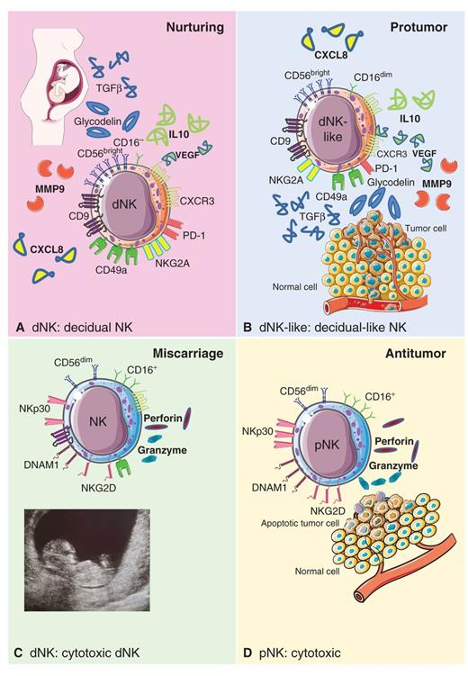 Decidual-Like NK Cell Polarization: From Cancer Killing to Cancer ...