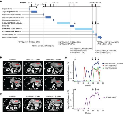 Figure 3. Treatment course for patient 46 with IHCC and FGFR2 p.H167_N173del EID. A, Timeline depicts patient's treatment course and duration of therapy. Notable somatic mutations detected on liver biopsies (black vertical lines) are listed below the timeline. The MAF is listed as a percentage next to the genomic alteration. Arrows correspond to time points when a new treatment was started, in reference to ddPCR analysis in D. Treatments with FGFR- and MAPK-targeted agents are highlighted in bold, and duration delineated with a lighter blue color. B, CT scans demonstrating the patient's liver lesions at baseline and after 6 and 14 weeks of Debio 1347 treatment. C, CT scans evaluating the patient's liver lesions at baseline and after 11 and 30.5 weeks of futibatinib (TAS-120) treatment. D, Selected alterations identified retrospectively in circulating cell-free DNA by ddPCR of serially banked plasma samples. Arrows correspond to time points when a new treatment was started in the clinical timeline in A.