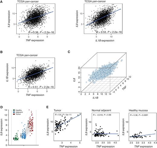TNF and IL1B mRNA correlate with IL8 mRNA in human tumor RNA sequencing databases. A, Bioinformatics correlative analyses of the relative levels of transcripts encoding TNF and IL1B with IL8 mRNA using all tumors annotated in TCGA (pan-cancer). B, Correlation between TNF and IL1B mRNA in the same database. C, Three-dimensional representation of the association of the transcripts for the three cytokines in TCGA. D, Relative expression of IL8 mRNA in primary colon cancer samples considering tumor, adjacent tissue, and nonmalignant colon mucosa using the Colonomics database. E, Correlation of TNF and IL8 transcripts in the Colonomics database and the lack of correlation in the nontransformed tissues from the same data repository. R coefficient and P value are shown for each correlation.