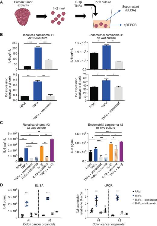 TNFα and IL-1β induce IL-8 from primary tumor organoids and fresh human tumor explants. A, Schematic representation of experiments on 1 to 2 mm3 tumor-derived fragments from surgical operations. IL-1β, TNFα, and etanercept were added as indicated. B, Expression of IL-8 released to the culture supernatants (mean of the concentration ± SD; top) or the mRNA expression in the tumor fragments (bottom). Three independent carcinoma specimens were tested from the indicated histology origins. C, Experiments as in B testing IL-8 release from two additional sets of fragments from independent tumor cases testing the effect of both IL-1β and TNFα as well as their respective blockade by anakinra, etanercept, or infliximab as indicated. D, Three-dimensional organoid cultures derived from two cases of colon cancer that were surgically excised at our institution and exposed to TNFα with or without etanercept or infliximab to measure IL-8 release to the supernatant (left) or the expression of IL8 encoding mRNA in such established carcinoma organoids (right). Experiments in A–C represent triplicates with separate fragments from fresh surgical samples (mean ± SD), and for D, dots represent pooled data from three independent experiments. The significance is represented with asterisks: *, P < 0.05; **, P < 0.01; ***, P < 0.001; ****, P < 0.0001.