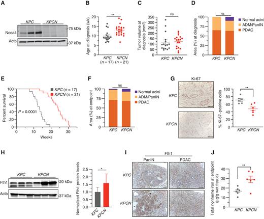Loss of Ncoa4 extends murine PDAC survival. A, Immunoblot showing Ncoa4 protein levels in lysates from tumor-derived cell lines from KPC and KPCN mice (n = 3 independent tumor-derived cell lines per genotype). B, Age at pancreatic tumor diagnosis as determined by high-resolution ultrasound. C, Tumor volume at time of diagnosis as measured by ultrasound; KPC, n = 16, KPCN, n = 18. D, Quantification of normal acinar, acinar-to-ductal metaplasia (ADM)/PanIN, and PDAC area in KPC (n = 4) versus KPCN (n = 3) pancreata at time of diagnosis as measured on hematoxylin and eosin (H&E) staining. E, Kaplan–Meier analysis comparing overall survival of KPC (n = 17) versus KPCN (n = 21) mice. Log-rank test, P < 0.0001. F, Quantification of normal acinar, ADM/PanIN, and PDAC area in KPC (n = 16) versus KPCN (n = 16) pancreata at endpoint as measured on H&E staining. G, Pancreatic tumors from KPC and KPCN tumors at endpoint stained with Ki-67 antibody; representative field displayed. The percentage of Ki-67–positive cells was counted in 5 fields from each tumor; n = 6 tumors per genotype; scale bars = 50 μm. H, Immunoblot showing Fth1 protein levels in lysates from tumor-derived cell lines from KPC and KPCN mice (n = 3 independent tumor-derived cell lines per genotype; quantification is of 3 KPC and 3 KPCN cell lines with 3 replicates). Lower band in the Fth1 blot is indicative of a lysosomal processed form of Fth1. Error bars  ±  SD. I, Fth1 immunostaining from PanIN and PDAC areas from representative KPC and KPCN pancreata; scale bars = 50 μm. J, Tumor nonheme iron levels in KPC versus KPCN tumors at endpoint; n = 6 tumors per genotype. For B–D and F–J, significance was determined with the t test. ns = not significant: P > 0.05; *, P < 0.05; **, P < 0.01. Error bars  ±  SEM.
