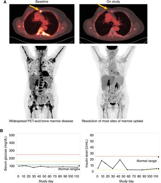 Discovery and Clinical Proof-of-Concept of RLY-2608, a First-in-Class ...