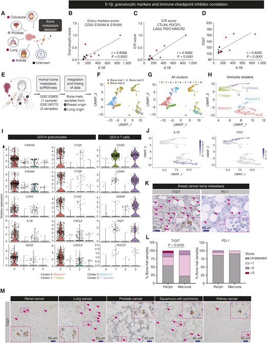 Human bone metastases are infiltrated by IL1β−expressing granulocytes and TIGIT-expressing T cells. A, Analyses of RNA-seq from human bone metastasis originating from different primary cancers (colorectal, prostate, lung, kidney, and unknown). B, Correlation between IL1B and granulocytic markers score (combining S100A8, S100A9, and CD33 expression). C, Correlation between IL1B and immune-checkpoint receptor score (combining PDCD1, TIGIT, TIM3, CTLA4, and LAG3). D, Correlation between IL1B and TIGIT. E, Integration and analysis of scRNA-seq data of human bone metastases originating from breast or lung cancer. F, All cells from scRNA-seq of 2 breast cancer bone metastases and 1 lung cancer bone metastases were projected onto a tSNE plot distinguished by different colors. G, Autoclusterization of all cells forming 9 clusters. H, Autoclusterization of immune cells forming 4 clusters: 2 myeloid and 2 lymphoid. I, Genes of interest in the myeloid/granulocytic cluster (cluster 0: orange); IL1B, S100A8, S100A9, and CD14 are expressed in the same cluster. Genes of interest in the T cytotoxic cluster (cluster 3: purple); ICR are expressed in CD8+ T cells. J, Feature plots of expression distribution for IL1B and TIGIT. Expression levels for each cell are color-coded and overlaid onto the UMAP plot. IL1B is almost exclusively expressed in the granulocytic-like cluster and TIGIT in the T-cell cluster. K, Representative images and (L) quantification of pathologic score of TIGIT or PD-1 in peripheral BM or metastatic core from human breast cancer bone metastases. n = 34 and 35 for TIGIT and PD-1, respectively. P value was calculated using X2 test. Pathologic scoring was given according to either intensity of staining or abundance of positive cells. M, Representative images of TIGIT staining in human bone metastasis from different primary origins. Renal cell carcinoma n = 10, lung cancer n = 6, prostate cancer n = 2, squamous cell carcinoma n = 1, and kidney cancer n = 3. Illustrations were created with BioRender.com.