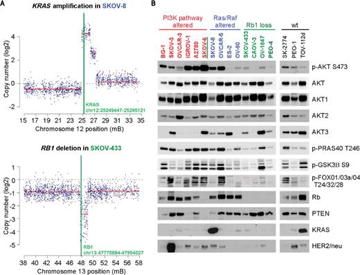 Figure 1. Genomic and proteomic profiling of ovarian cancer cell lines. A, probe-level (blue dots) and segmentation data (red lines) from Agilent 244K arrays identifying representative focal amplification (KRAS in SKOV-8) and focal homozygous deletion (RB1 in SKOV-433) events. The vertical green line crosses the x-axis at the chromosomal position of the gene. Y-axis indicates log2 copy number signal. B, immunoblot analysis of the ovarian cancer cell line panel for expression of AKT1/2/3, phosphorylated AKT (Ser473), and activation and abundance of key downstream targets. Cells were arranged based on the presence of PI3K/AKT (red) or RAS/RAF-pathway alterations (blue) and RB1 loss (green and green underline).