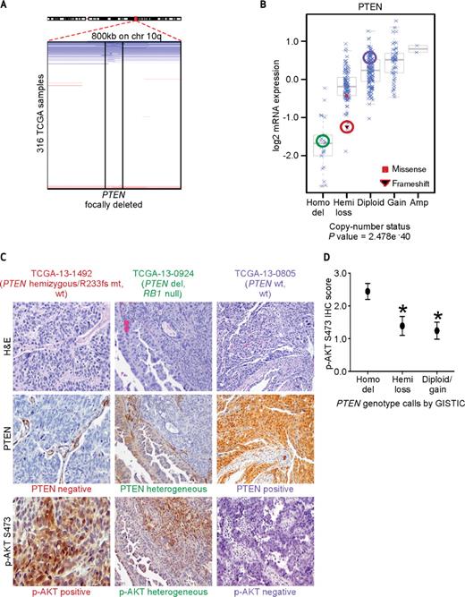 Figure 6. PTEN genotype frequently dictates PTEN expression status, but evidence of heterogeneous staining implies polyclonality within some ovarian tumors. A, copy number heat map of the ovarian TCGA samples showing that a subset harbor focal deletion of the PTEN locus. X-axis represents the copy number status (blue: deletion, white: copy neutral, red: amplification) of the PTEN gene for each of the 316 TCGA samples listed on y-axis. B, log2 mRNA expression as a function of GISTIC-based copy number status at the PTEN locus (P values as indicated, analysis of variance). Circled tumors indicate PTEN mRNA and copy number status of the corresponding tumors in part C. C, hematoxylin and eosin (H&E), PTEN, and p-AKT S473 immunohistochemistry of representative ovarian TCGA tumors with PTEN-negative, heterogeneous, and positive staining. D, mean p-AKT S473 IHC scores as a function of GISTIC-based copy number calls at the PTEN locus. Dots represent average p-AKT IHC score ± SE for each group (asterisks indicate P ≤ 0.0276 versus PTEN homozygous deleted).