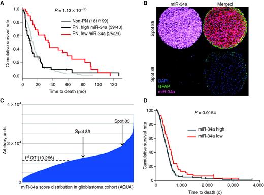 Figure 3. miR-34a levels are prognostic in glioblastoma. A, Kaplan–Meier survival analysis of patients in the TCGA data set (n = 271). Low expression of miR-34a stratifies a subgroup of patients with proneural (PN) glioblastoma with a significant survival advantage compared with others in TCGA cohort (log-rank P = 1.12 × 10−5). B, glioblastoma tissue microarray. Representative spots showing high and low expressors. A locked nucleic acid–modified probe for miR-34a and an antibody specific for glial fibrillar acidic protein (GFAP) were hybridized to the arrays. C, Automated Quantitative Analysis (AQUA) score distribution across the glioblastoma cohort. Arrows indicate the AQUA score for the samples shown in B. QT, quartile. D, Kaplan–Meier survival analysis of patients in the independent training cohort (n = 220). Subjects were stratified in high and low miR-34a expressors based on the quantile expression assessed by the AQUA score. First (lower) quartile of the AQUA score distribution was used as cutoff to assign patients to the low or high expressors groups. “miR-34a low” patients show a significant better outcome than “high expressors” (P = 0.0154).