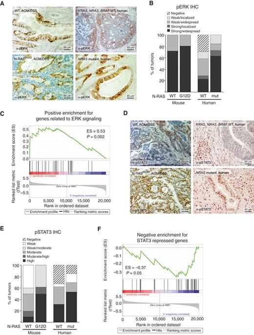 Figure 5. Activation of ERK and STAT3 in primary tumors expressing mutant N-RAS. A, immunohistochemistry for phospho-ERK in autochthonous mouse and human tumors. B, quantification of phospho-ERK staining in primary tumors. Staining was considerably less variable in mouse tumors (n = 10 for WT mouse tumors, n = 7 for N-RASG12D mouse tumors, n = 17 for WT human cancers, and n = 19 for NRAS-mutant human cancers). C, enrichment plot for NRAS-mutant colorectal cancer. Genes related to ERK signaling were significantly enriched in cancers expressing mutant N-RAS. D, immunohistochemistry for phospho-STAT3 in autochthonous mouse and human tumors. E, evaluation of phospho-STAT3 staining in primary colonic tumors from animals treated with AOM/DSS (n = 10 for WT tumors, n = 8 for N-RASG12D tumors, n = 17 for WT human cancers, n = 19 for NRAS-mutant human cancers). F, enrichment plot for NRAS-mutant colorectal cancer. Genes downregulated by STAT3 were negatively enriched in cancers expressing mutant N-RAS.