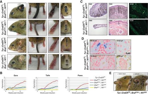 Figure 2. Nf1 and Braf mutations cooperate in vivo and lead to enhanced melanocyte proliferation. A, phenotype of mice with the indicated genotypes 7 months after Tyr::CreERT2 induction. B, quantification of pigmentation phenotype of different genotypes over time following Tyr::CreERT2 induction. C, histologic images of ears (left) and tails (middle) from mice with the specified genotypes 9 months after tamoxifen treatment. Brackets indicate dermis in respective tissues at same magnification. S100 expression was evaluated by immunofluorescent staining (right). D, sections of ear stained for eosin and SA-β-gal (light blue) from tamoxifen-treated Tyr::CreERT2; BrafCA/+; Nf1+/+ (top) and Tyr::CreERT2; BrafCA/+; Nf1flox/flox (bottom) mice. Note the blue staining and cell morphology differences. E, Tyr::CreERT2; BrafCA/+; Nf1flox/flox mice were treated daily with the PI3K inhibitor GDC-0941 (150 mg/kg) or vehicle for 8 weeks after Tyr::CreERT2 induction. The hyperpigmentation phenotype was prevented by GDC-0941 treatment.