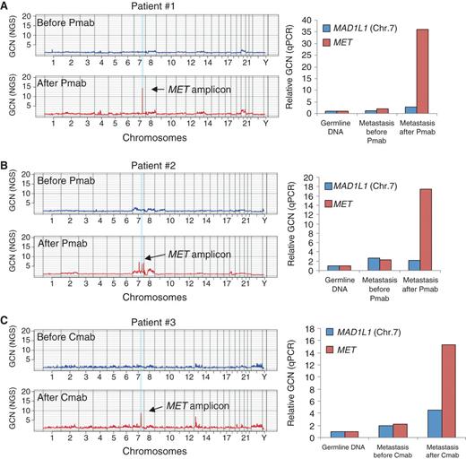 Figure 1. Whole-exome analysis reveals increased MET copy number in colorectal cancer samples from patients who developed resistance to anti-EGFR treatment. A–C, left, whole-exome gene copy number (GCN) analysis of colorectal cancer tumor samples from 3 patients taken before (blue) and after (red) therapy with the EGFR-targeted monoclonal antibodies panitumumab (Pmab; patients #1 and #2) or cetuximab (Cmab; patient #3). Individual chromosomes are indicated on the x-axis. The lines indicate the sequencing depth as copy number values relative to a diploid exome (y-axis) over windows of 500,000 base pairs. A–C, right, MET amplification was confirmed in the paired tumor samples by qPCR gene copy number analysis. MAD1L1, reference gene on Chr.7.