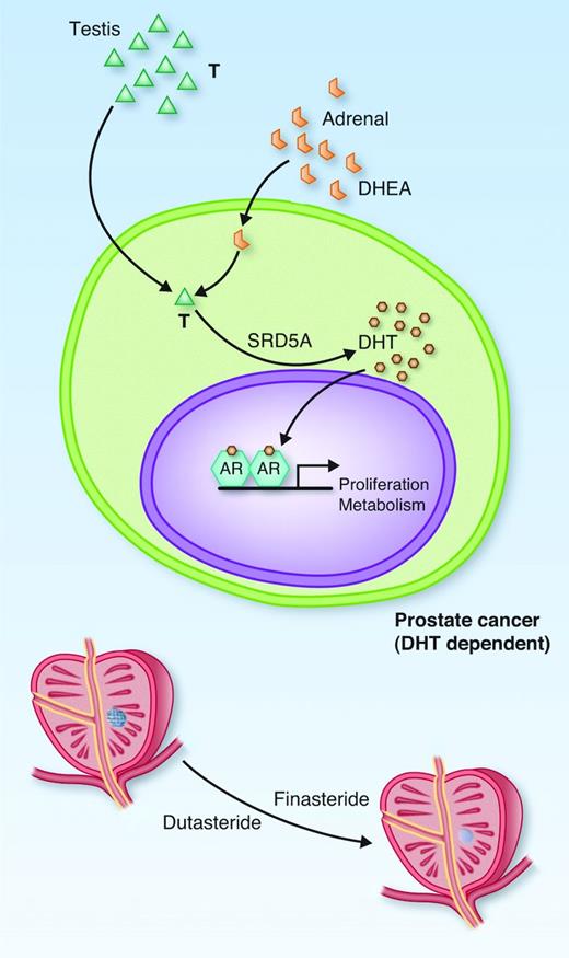 Molecular Classification of Prostate Cancer Progression Foundation for