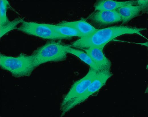 Merck's PD-1 inhibitor pembrolizumab received FDA approval for the treatment of melanoma (above) in September. A similar drug from Bristol-Myers Squibb, nivolumab, may soon follow suit.