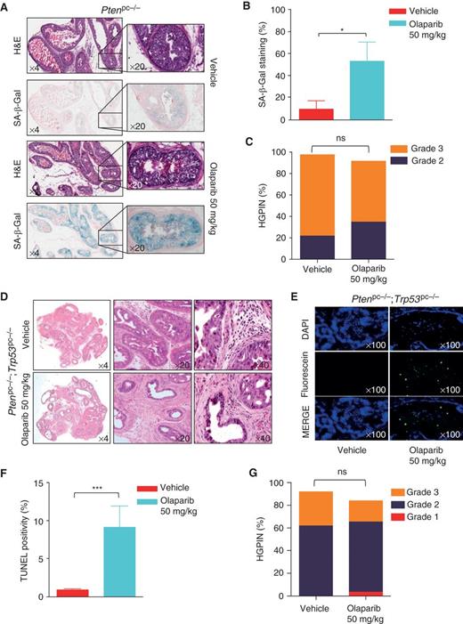 Figure 2. PARP inhibition induces a differential response in vivo with a modest effect on overall tumor response. A, SA-β-gal staining in prostates of 8-week-old Ptenpc−/− mice upon olaparib (n = 3) or vehicle (n = 3) treatment for 2 weeks. B, quantification of SA-β-gal positivity from A (*, P = 0.0419). C, histopathologic analysis of HGPIN status from A. D, hematoxylin and eosin (H&E) staining of DLP tumors from 4-month-old Ptenpc−/−;Trp53pc−/− mice upon olaparib (n = 3) or vehicle (n = 3) treatment for 1 week. E, TUNEL staining to visualize apoptosis induction in D and F, its quantification (***, P = 0.0006). DAPI, 4,6-diamidino-2-phenylindole. G, histopathologic analysis of HGPIN status from D. ns, not significant.