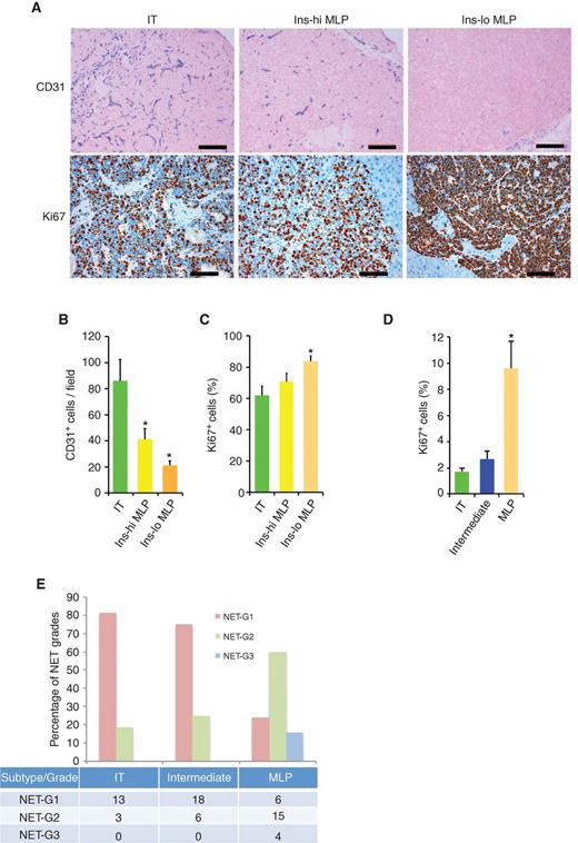 Figure 4. Vascular and proliferative characteristics of human and mouse PanNETs. A, CD31 (top) and Ki67 (bottom) staining in RT2 tumor subtypes. Images are representative of the analysis of 60 tumor-bearing RT2 B6, B6AF1, and B6D2F1 mice (see Methods section for different strains of the RT2 mouse model). In the top plot, blue represents CD31, pink represents nucleus, and scale bar represents 200 μm; in the bottom plot, red represents Ki67, blue represents nucleus, and scale bar represents 100 μm. B and C, quantification of CD31-positive blood vessels (B) and Ki67-positive tumor cells (C) in different subtypes of RT2 tumor subtypes. The quantitation is representative of the analysis of 10 random fields from 10 different tumor-bearing RT2 B6, B6AF1, and B6D2F1 mice from the analysis illustrated in A. D, percentage of Ki67-positive cells in human PanNET subtypes (from the samples of the core clinical gene expression dataset; see Methods section for detailed description about quantitation). * represents statistical P value < 0.05 as measured using the Student t test comparing IT versus Ins-hi MLP and IT versus Ins-lo MLP. Error bars in the graphs represent SD. E, identifiable percentage and summary (number of samples in the table) of NET grades in human PanNET subtypes. NET grades are significantly (P < 0.05; Fisher exact test) associated with PanNET subtypes.