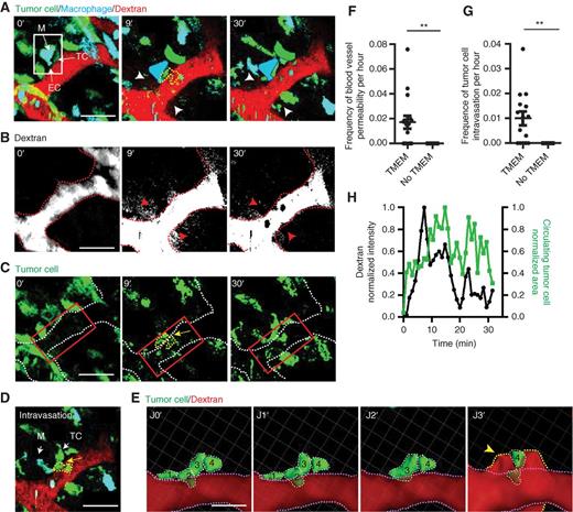 Figure 2. Transient, local blood vessel permeability events accompany intravasation at the TMEM. A, IVM time lapse of 155-kDa dextran–TMR extravasation and tumor cell intravasation. TMEM, white box. Blood vessel permeability sites (white arrowheads) and intravasating tumor cell (TC; yellow dashed line, 9′). Clearance of dextran and decrease of CTCs at 30′. Scale bar, 50 μm. At 9′ and 30′, TMEM tumor cells and macrophages are added in false color to increase visibility after bleaching. B, isolated 155-kDa dextran–TMR channel from A. Red arrowheads mark dextran extravasation (white). Dashed red line, luminal side of the endothelium. C, isolated tumor cell channel from A. Yellow arrow marks site of intravasating tumor cell (yellow dashed line) at the TMEM. White dashed line marks the luminal surface of the endothelium. Red box, region adjacent to the TMEM with elevated CTCs. D, single time point of tumor cell intravasation (yellow dashed line) by time-lapse IVM. Scale bar, 50 μm. E, 3D reconstruction of time-lapse IVM from D of tumor cell intravasation at the TMEM. Transmigrating tumor cells (individually numbered, dashed white lines) are isolated from other cell types for clarity with time in minutes from start (J0′) to end of transmigration (J3′). The luminal endothelial surface is outlined in a pink dashed line. Extravascular dextran (red) at the TMEM indicated with a yellow arrowhead and outlined in a yellow dashed line. F, frequency of blood vessel permeability events in the presence of the TMEM or away from the TMEM in 100-μm windows (see Supplementary Fig. S4; n = 16; **, P = 0.0034). G, frequency of tumor cell intravasation events in the presence of the TMEM or away from the TMEM in 100-μm windows (n = 16; **, P = 0.0012). H, quantification of extravascular dextran intensity and CTC area at the TMEM over time from A. , extravascular dextran; , CTC.