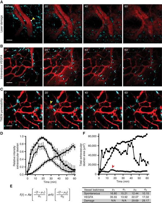 Figure 3. TMEM-mediated vascular permeability is transient and localized. A, time-lapse imaging demonstrates that laser-induced damage to the endothelium creates a hole allowing for extravasation of 155-kDa dextran–TMR. The location of the hole is marked by a white dot (2 μm) and a yellow arrowhead. 155-kDa dextran–TMR extravasates and increases over time up to 60′ filling the field of view and not clearing from the tissue (n = 4). Scale bar, 50 μm. B, 155-kDa dextran–TMR is injected by tail vein i.v. catheter followed by 8 μg of VEGFA165 at 0′. VEGFA165 induces blood vessel permeability in all of the blood vessels in the field of view. Peak extravascular dextran is observed at 20′ followed by clearance by 60′ after resealing of vascular junctions (n = 4). Scale bar, 50 μm. C, spontaneous vascular permeability at the TMEM is both transient and local. Local peak extravasation of 155-kDa dextran–TMR occurs after 20′ (yellow arrowhead) and clears within 60′ (n = 11). Scale bar, 50 μm. D, quantification of average relative intensity of extravascular 155-kDa dextran–TMR after () laser damage (n = 4), () intravenous VEGFA165 (n = 4), and () spontaneous permeability (n = 11). E, table of parameters from curve fitting to an Exponentially Modified Gaussian function using data from D. F, quantification of total extravascular 155-kDa dextran–TMR area after laser-induced damage, i.v. injection of VEGFA165, or spontaneous permeability at the TMEM from individual animals represented in A, B, and C. Peak of 155-kDa dextran–TMR area in spontaneous permeability at the TMEM indicated with a red arrowhead. , laser damage; , intravenous VEGFA165; , spontaneous vascular permeability at the TMEM.