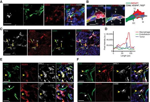 Figure 5. TIE2hi/VEGFAhi TEMs are present in the TMEM. A, immunofluorescence imaging of the TMEM. Macrophages (CD68; gray), blood vessels (CD31; green), tumor cells (MENA; red), and DAPI (blue). TMEM in white box (right). Scale bar, 15 μm. B, immunofluorescence imaging of VEGFAhi macrophages in the TMEM in sequential sections. Scale bar, 10 μm. Tumor cell, spotted line; macrophages, solid line; and blood vessels, dashed line. Left, macrophages (CD68; gray), tumor cells (MENA; red), blood vessels (CD31; green), and DAPI (blue). Sequential section (center), VEGFA (red), TIE2 (gray), blood vessels (CD31; green), and DAPI (blue). Schematic representation (right) of protein expression in the TMEM; tumor cells with MENAhi (red); endothelial cells CD31 (green); and macrophages CD68, VEGFAhi, and TIE2hi (gray). M, macrophage; TC, tumor cell; and EC, endothelial cell. C, immunofluorescence images of TIE2, VEGFA, and CD31. Yellow lines, regions of intensity profiling of VEGFA intensity for CD31 (EC), macrophage (M), and tumor cells (TC). Scale bar, 25 μm. D, fluorescence intensity profile of VEGFA from C of macrophage, endothelial cell, and tumor cells. E, immunofluorescence imaging of sequential PyMT tumor sections for TEM markers. VEGFAhi TMEM macrophages express F4/80, MRC1, CD11b, and CD68 as indicated by a yellow arrowhead in sequential sections. CD31+ endothelium is indicated by a white arrowhead. F, VEGFAhi TMEM macrophages express TIE2, MRC1, and CD68 but not CD11c as indicated by a yellow arrowhead. CD31+/TIE2+ endothelium is indicated by a white arrowhead. Scale bar, 25 μm.