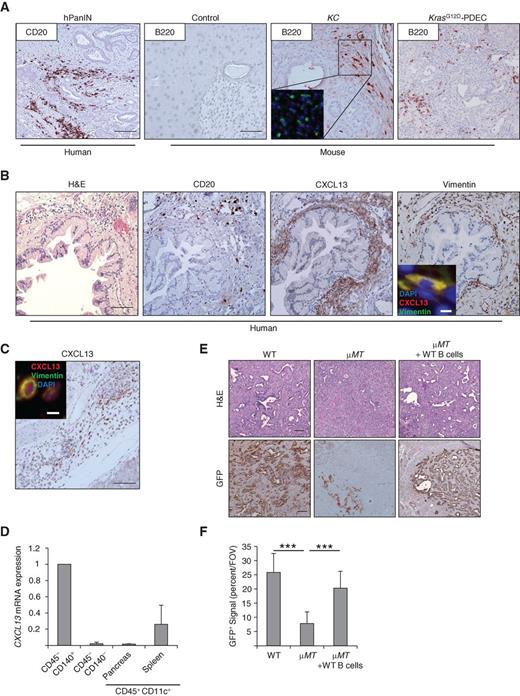 Figure 1. B cells infiltrate mouse and human pancreatic neoplasia and promote growth of KrasG12D-PDEC in vivo. A, IHC detection of B cells in human (CD20 staining) and mouse (B220 staining) in pancreata from hPanIN (20 patient samples), p48Cre (control, 5 mice), KC (10 mice), or KrasG12D-PDEC (9 mice) orthotopic lesions, as indicated. Inset, B cells in the parenchyma of an adjacent tissue section detected by immunofluorescence using anti-CD19 (green) and DAPI (blue). Representative images are shown. Scale bars, 100 μm. B, hematoxylin and eosin (H&E) staining and IHC staining for CD20, CXCL13, and vimentin from serial sections in a representative sample of human pancreatic cancer containing PanIN lesions. Inset, sections of human PanIN lesions were stained by immunofluorescence (CXCL13, red; vimentin, green; and DAPI, blue). Scale bars, 100 μm; inset, 7.5 μm. C, serial sections of a KC mouse pancreas were stained by IHC with CXCL13 or immunofluorescence (n = 10; CXCL13, red; vimentin, green; and DAPI, blue). A representative image is shown. Scale bars, 100 μm and 12 μm (inset). D, expression of Cxcl13 mRNA in cellular subsets isolated from pancreata of KC mice. Error bars indicate SD (n = 6). E, sections from orthotopic pancreatic grafts 2 weeks after GFP-KRasG12D-PDEC implantation into WT or μMT mice were stained with hematoxylin and eosin or anti-GFP antibody. Where indicated, μMT mice were reconstituted with WT B cells 2 days prior to orthotopic implantation. Representative images are shown. Scale bars, 100 μm. F, graph depicts quantification of the data in E and indicates the average fraction of GFP+ signal per field of view (FOV; 10 fields of view per animal; n = 12 WT, n = 14 μMT, n = 9 μMT+WT B cell animals). Error bars indicate SD; P values were determined by the Student t test (unpaired, two-tailed); ***, P < 0.001.