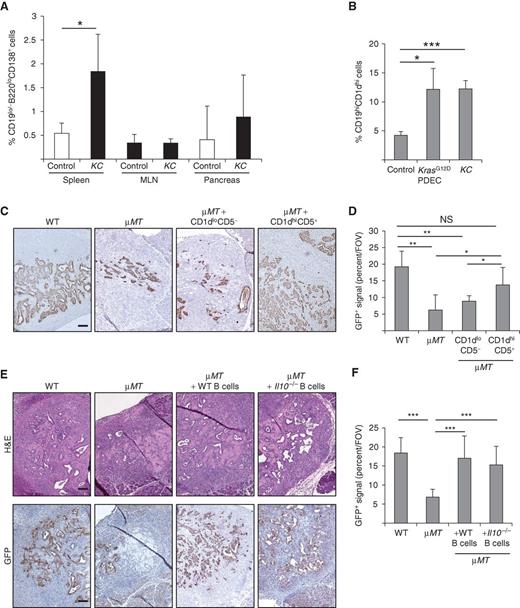 Figure 2. CD1dhiCD5+ B cells are expanded in pancreatic neoplasia and are functionally important for sustaining growth of KrasG12D-PDEC in vivo. A, quantification of flow cytometric analysis of plasma cells from spleens, mesenteric lymph nodes (MLN), and pancreata of p48Cre (control) or KC mice. Cells were analyzed for the presence of markers CD19, B220, and CD138 (n = 5 p48Cre, n = 5 KC). B, quantification of flow cytometric analysis of immune cells from pancreata of p48Cre (control) mice, KC mice (2.5 mo), or KrasG12D-PDEC orthotopic lesions (2 weeks), as indicated. After gating on CD19 and CD1d populations, cells were analyzed for the presence of CD5 marker (n = 8 p48Cre, n = 8 KrasG12D-PDEC, n = 8 KC). C, sections from orthotopic pancreatic grafts 2 weeks after GFP-KrasG12D-PDEC implantation into WT or μMT mice were stained with anti-GFP antibody. Where indicated, μMT mice were reconstituted with WT CD19+CD1dhiCD5+ or with CD19+CD1dloCD5− 2 days prior to orthotopic implantation. Representative images are shown. Scale bars, 100 μm. D, graph depicts quantification of the data from C indicating the average fraction of GFP+ area per field of view (FOV) of the implant (10 fields of view per animal; n = 12 WT, n = 11 μMT, n = 9 μMT+ CD1dloCD5−, n = 9 μMT+ CD1dhiCD5+, animals). E, sections from orthotopic pancreatic grafts 2 weeks after GFP-KrasG12D-PDEC implantation into WT or μMT mice were stained with H&E or anti-GFP antibody. Where indicated, μMT mice were reconstituted with WT B cells or with Il10−/− B cells 2 days prior to orthotopic implantation. Representative images are shown. Scale bars, 100 μm. F, graph depicts quantification of the data from E indicating the average fraction of GFP+ area per field of view of the implant (10 fields of view per animal; n = 14 WT, n = 12 μMT, n = 12 μMT+WT B cell, n = 12 μMT+Il10−/− B cell animals). Error bars indicate SD; P values were determined by the Student t test (unpaired, two-tailed); *, P < 0.05; **, P < 0.01; ***, P < 0.001; NS, not significant.