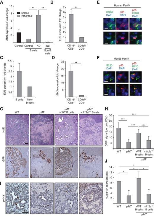 Figure 3. Expression of IL35 by B cells is functionally important for sustaining growth of KrasG12D-PDEC in vivo. A, levels of Il12a mRNA in immune cells from spleen or pancreata of p48Cre (control) or KC mice were assessed by quantitative RT-PCR (n = 9 Trp48Cre, n = 9 KC). B, levels of Il12a mRNA in CD19+CD1dhiCD5+ and CD19+CD1dloCD5− subpopulations of B cells sorted from pancreata of KC mice were assessed by quantitative RT-PCR (n = 9 KC). C, levels of Ebi3 mRNA in B cells and non-B cells from pancreata of KC mice were assessed by quantitative RT-PCR (n = 9 KC). D, levels of Ebi3 mRNA in CD19+CD1dhiCD5+ and CD19+CD1dloCD5− subpopulations of B cells sorted from pancreata of KC mice were assessed by quantitative RT-PCR (n = 9 KC). E, immunofluorescence staining for p35 and CD20 in samples of human pancreatic cancer containing PanIN lesions. Scale bars, 10 μm (top) and 20 μm (bottom). Two independent fields of view (FOV) are shown. F, immunofluorescence staining for p35 and B220 in samples of KC pancreata. Scale bars, 20 μm. Two independent fields of view are shown. G, sections from orthotopic pancreatic grafts 2 weeks after GFP-KrasG12D-PDEC implantation into WT or μMT mice were stained with hematoxylin and eosin (H&E) or anti-GFP antibody. Where indicated, μMT mice were reconstituted with WT B cells or with Il12a−/− B cells 2 days prior to orthotopic implantation. Representative images are shown. Scale bars, 100 μm. H, graph depicts quantification of the data from G indicating the average fraction of GFP+ area per field of view of the implant (10 fields of view per animal; n = 9 WT, n = 9 μMT, n = 9 μMT+WT B cell, n = 9 μMT+Il12a−/− B cell animals). I, IHC staining for phospho-Histone H3 (pHH3) of GFP-KrasG12D-PDEC implanted into mice as described in G above. Representative images are shown. Scale bars, 50 μm. J, graph depicts quantification of the data in I and indicates the fraction of phospho-Histone H3+ signal in epithelial cells (10 fields of view per animal; n = 6 WT, n = 6 μMT, n = 6 μMT+WT B cell, n = 6 μMT+Il12a−/− B-cell animals). Error bars indicate SEM in A, SD in B–D, H, and J; P values were determined by the Student t test (unpaired, two-tailed); *, P < 0.05; **, P < 0.01; ***, P < 0.001.