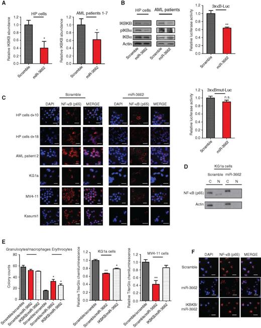 Figure 4. Identification of IKBKB as a direct target of miR-3662. A, effect of forced expression of miR-3662 on IKBKB abundance in HP cells and primary AML patient blasts. Left, relative IKBKB abundance determined by qPCR, displayed as mean ± SD. *, P < 0.05. P values were determined using two-tailed Student t tests (equal variance). Right, Western blots depicting IKBKB abundance and phosphorylation of IKBα (pIKBα). The experiment was repeated twice, confirming the results. B, effects of miR-3662 on the transcriptional activation potential of NF-κB. 3xkB-Luc shows the effects of miR-3662 versus scramble control on a luciferase construct containing three NF-κB binding motifs. 3xkBmut-Luc shows the effects of miR-3662 versus scramble control on a luciferase construct containing three mutated forms of the NF-κB binding motifs. n = 3 biological replicates, displayed as mean ± SD. **, P < 0.005. P values were determined using two-tailed Student t tests (equal variance). C, effects of miR-3662 on the nuclear localization of NF-κB in various cell types visualized by confocal microscopy. DAPI (blue) shows the cell nuclei and NF-κB p65 (red) shows NF-κB. MERGE depicts the combined images of DAPI/NF-κB. White scale bars, 20 μm. D, effects of miR-3662 on the nuclear localization of NF-κB in KG1a cells visualized by Western blotting after subcellular fractionation. C, cytoplasmic fraction of KG1a lysates; N, nuclear fraction of KG1a lysates. The experiment was repeated twice, confirming the results. E, IKBKB-mediated rescue of miR-3662′s effects. Left, total colony counts after coinfection with miR-3662 in HP cells stably expressing IKBKB or scramble control. Middle and right, chemiluminescent TiterGlo assay showing the effects of forced miR-3662 expression on the viability of AML cell lines stably expressing IKBKB or scramble control. n = 3 biological replicates, displayed as mean ± SD. **, P < 0.005. P values were determined using two-tailed Student t tests (equal variance). F, effects of miR-3662 on the nuclear localization of NF-κB in KG1a cells stably expressing IKBKB, visualized by confocal microscopy. DAPI (blue) shows the cell nuclei, and NF-κB p65 (red) shows NF-κB. MERGE depicts the combined images of DAPI/NF-κB. The white scale bars indicate a length of 20 μm. The experiment was repeated twice, confirming the results.