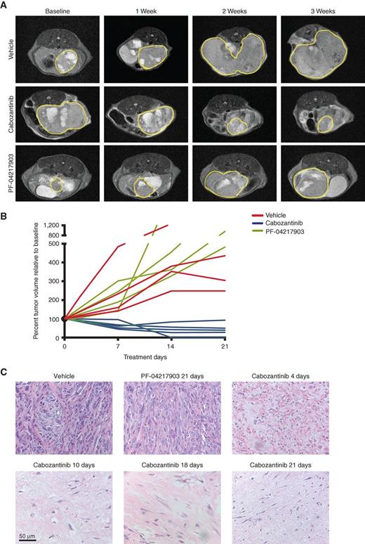 Figure 1. Cabozantinib causes tumor regression and near-complete clearance of invasive poorly differentiated murine prostate cancer. A, Representative MRI images showing the relative impact of vehicle (top), cabozantinib (middle), and the c-MET inhibitor PF-04217903 (bottom), on regression of established murine PTEN/p53-deficient prostate tumors. Mice were treated with the indicated drugs at the following concentrations: vehicle control, cabozantinib (100 mg/kg), and PF-04217903 (50 mg/kg). The yellow borders mark solid tumor boundaries during the 3-week course of treatment. B, Volumetric analysis showed significant tumor regression in mice treated with cabozantinib, but not vehicle or PF-04217903 treatment. C, Hematoxylin and eosin (H&E) staining of tumors from cabozantinib-treated mice revealed near-complete eradication of poorly differentiated prostate tumors at 4, 10, 18, and 21 days of treatment, not observed with vehicle- or PF-04217903–treated mice (n = 4 mice per treatment arm/time point).