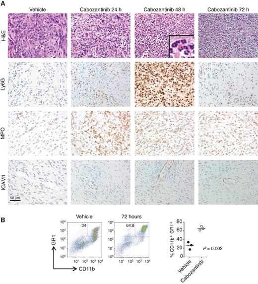 Figure 2. Cabozantinib induces extensive infiltration of neutrophils into the tumor bed and near-complete clearance of invasive poorly differentiated murine prostate cancer within 48 to 72 hours of drug treatment. A, H&E, Ly6G, MPO, and ICAM1 staining of established prostate tumors harvested from Pb-Cre; Ptenfl/flTrp53fl/fl mice treated with vehicle, 24, 48, and 72 hours of cabozantinib (100 mg/kg) treatment, respectively. Mice were treated with vehicle or cabozantinib for the indicated times, and tumor tissues were stained with either H&E or the indicated antibodies by IHC. These data show an increase in Ly6G-positive and MPO-positive neutrophils, and an increase in ICAM1-postive endothelium within 48 hours of cabozantinib treatment. B, Flow cytometry analysis of dissociated tumor showed a similar increase in CD11b+GR1+ tumor-infiltrating neutrophils with cabozantinib treatment.