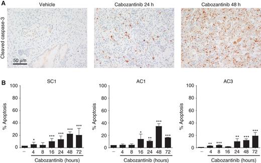 Figure 3. Cabozantinib causes significant tumor cell elimination in vivo, but modest apoptosis induction in vitro. A, Cabozantinib acutely increased caspase-3 staining within 24 to 48 hours of treatment in established murine PTEN/p53-deficient prostate tumors. Mice were treated with cabozantinib for the indicated times, and prostate tumor tissues were stained with caspase-3 antibody by IHC. Images show representative sections from n = 3 mice per time point. B, PTEN/p53-deficient prostate tumor–derived cell lines treated with cabozantinib showed only modest cell death. SC1, AC1, and AC3 cells were treated with 30 μmol/L cabozantinib for the indicated times, followed by apoptosis analysis with Annexin V staining (n = 3 experiments). *, P < 0.05; **, P < 0.01; ***, P < 0.001.