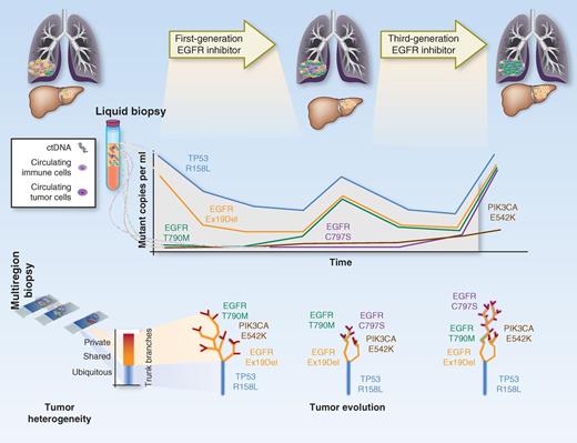 Figure 2. Diagnostic approaches to measure the impact of cancer therapies on clonal evolution. Tumors are molecularly heterogeneous. Multiregion biopsies provide a snapshot of this heterogeneity, allowing the reconstruction of a tumor phylogenetic tree and the identification of ubiquitous, shared, or private alterations. Liquid biopsy allows, through ctDNA analysis, real-time monitoring of changes in tumor heterogeneity under the selective pressure of anticancer treatments. Analysis of the allelic frequencies of subclonal alterations provides a measure of growth dynamics of the different cell populations within a tumor, whereas quantification of trunk alterations allows normalization for tumor burden. Circulating tumor cells could integrate biological information obtained by ctDNA sequencing, and circulating immune cells could help describe the evolution of the tumor-responsive immune microenvironment.
