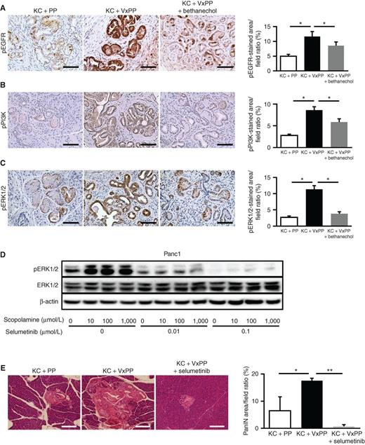 Figure 4. Muscarinic signaling inhibits downstream EGFR/MAPK and PI3K/AKT signaling in PDAC cells. A–C, Representative images of IHC for pEGFR (A), pPI3K (B), and pERK1/2 (C) in pancreatic sections from KC + PP mice, KC + VxPP mice, and KC + VxPP + bethanechol mice. Bar graphs show quantification of pEGFR, pPI3K, or pERK1/2 staining in pancreata from KC + PP mice, KC + VxPP mice, and KC + VxPP + bethanechol mice (n = 3, each group). D, Representative western blot showing pERK1/2 and ERK1/2 relative to β-actin in Panc1 cells after treatment with indicated dosages of scopolamine and selumetinib. E, Representative H&E-stained images of pancreatic sections from KC + PP mice, KC + VxPP mice, and KC + VxPP + selumetinib mice. Bar graph shows quantification of PanIN area in pancreata from KC + PP mice, KC + VxPP mice, and KC + VxPP + selumetinib mice (n = 3, each group). Scale bars, 100 μm; mean ± SD. *, P < 0.05; **, P < 0.01.